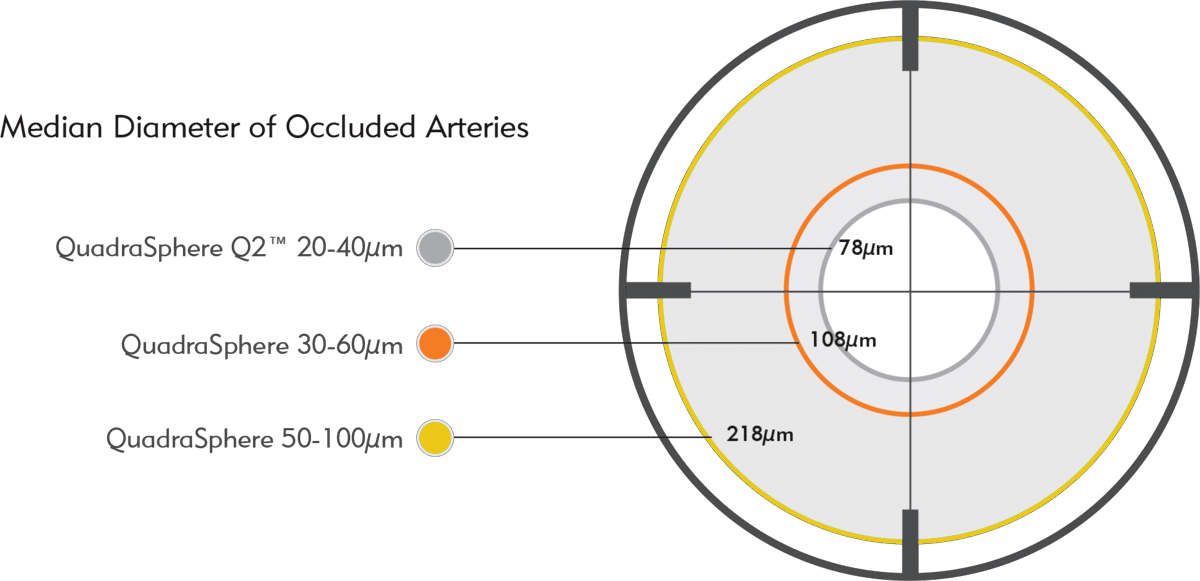 Image shows median diameter of occluded arteries by Quadrasphere sizes