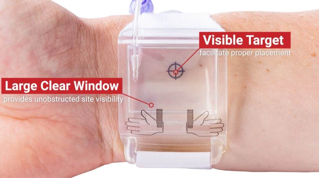 PreludeSYNC EZ™ Radial Compression Device Merit Medical