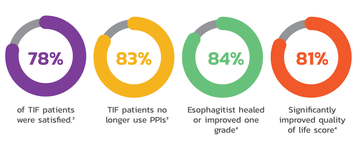 Infographic showing 4 circular representations of specific rates. Purple circle: 78% of TIF patients were satisfied. Yellow Circle: 83% of TIF patients no longer use PPIs. Green circle: 84% of esophagitist healed or improved one grade. Orange circle: 81% significantly improved quality of life.